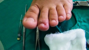 Paola Duran Avisos gratis en Chile en Castro |  Podologia Sur, Podologia a domicilio